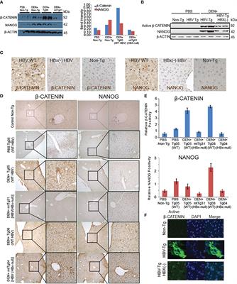 β-CATENIN stabilizes HIF2 through lncRNA and inhibits intravenous immunoglobulin immunotherapy